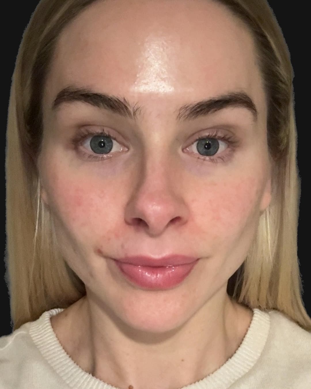 Jo's skin scan showing natural skin texture