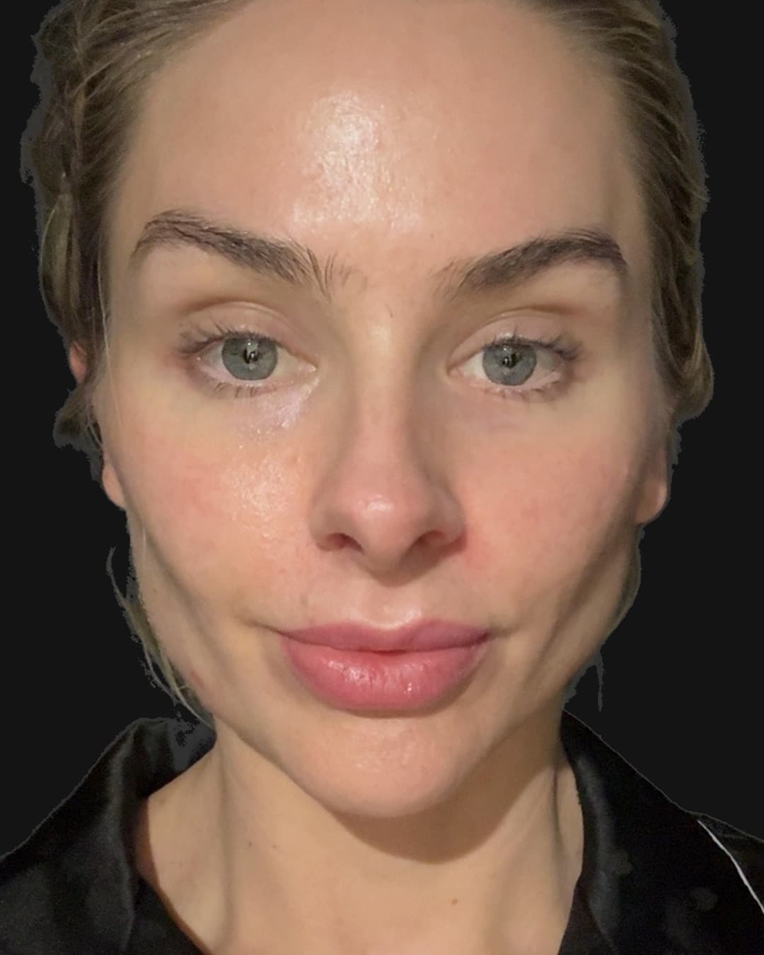 Jo's skin scan on 8 May 2026