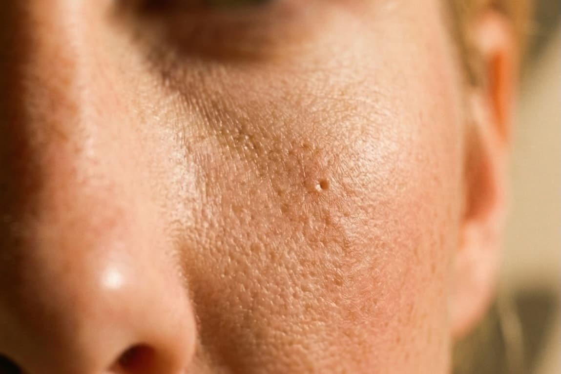 Close-up of a cheek showing natural skin texture