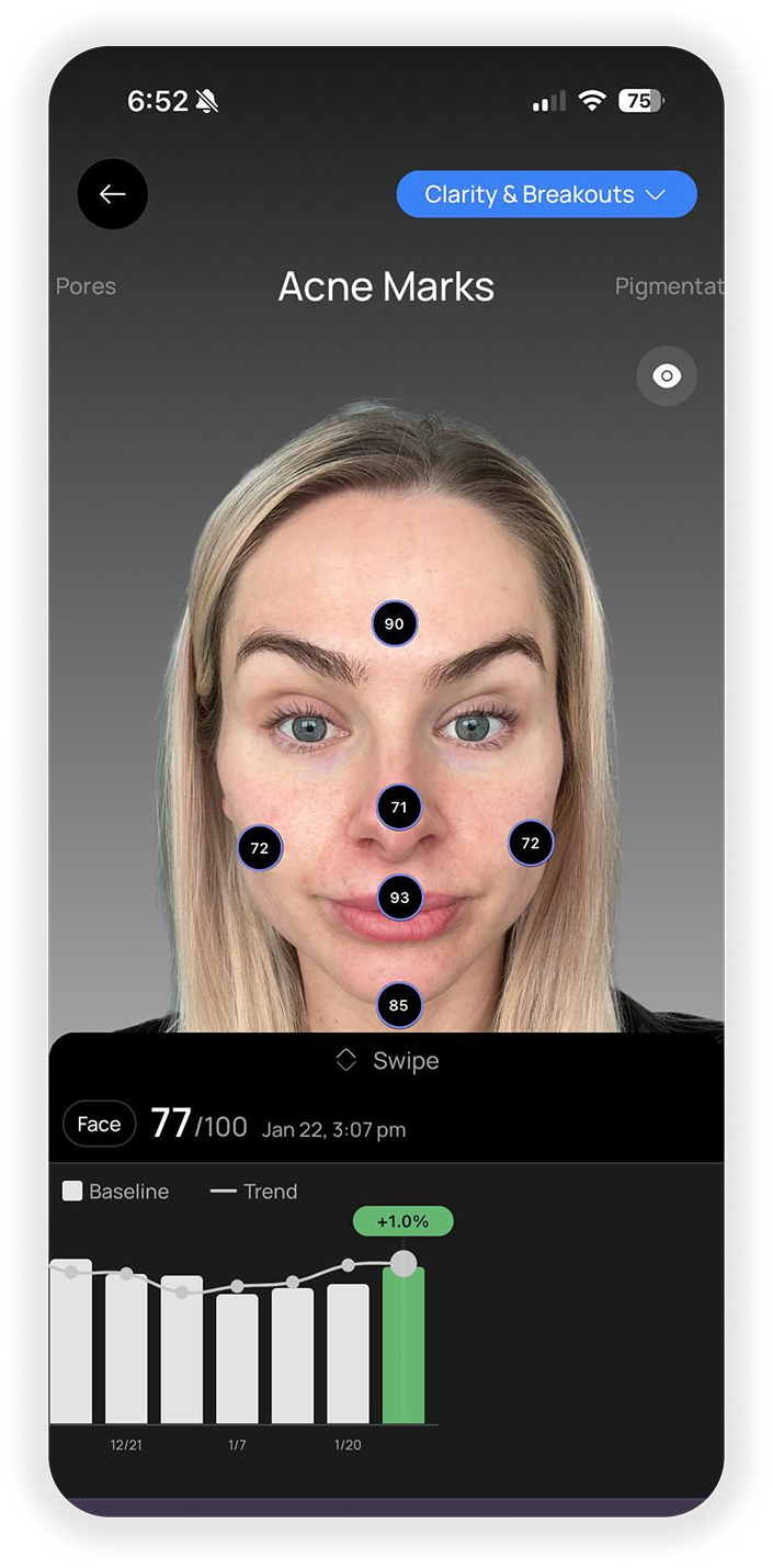 Skin and health data connected in Stella
