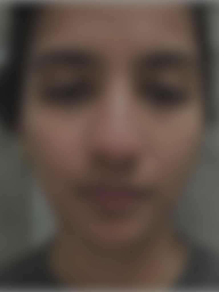 Series of close-up skin images showing different skin concerns tracked by Stella, including redness, pigmentation, and texture.