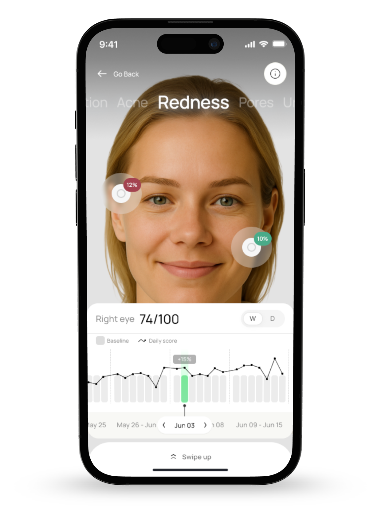 Stella skin scan example