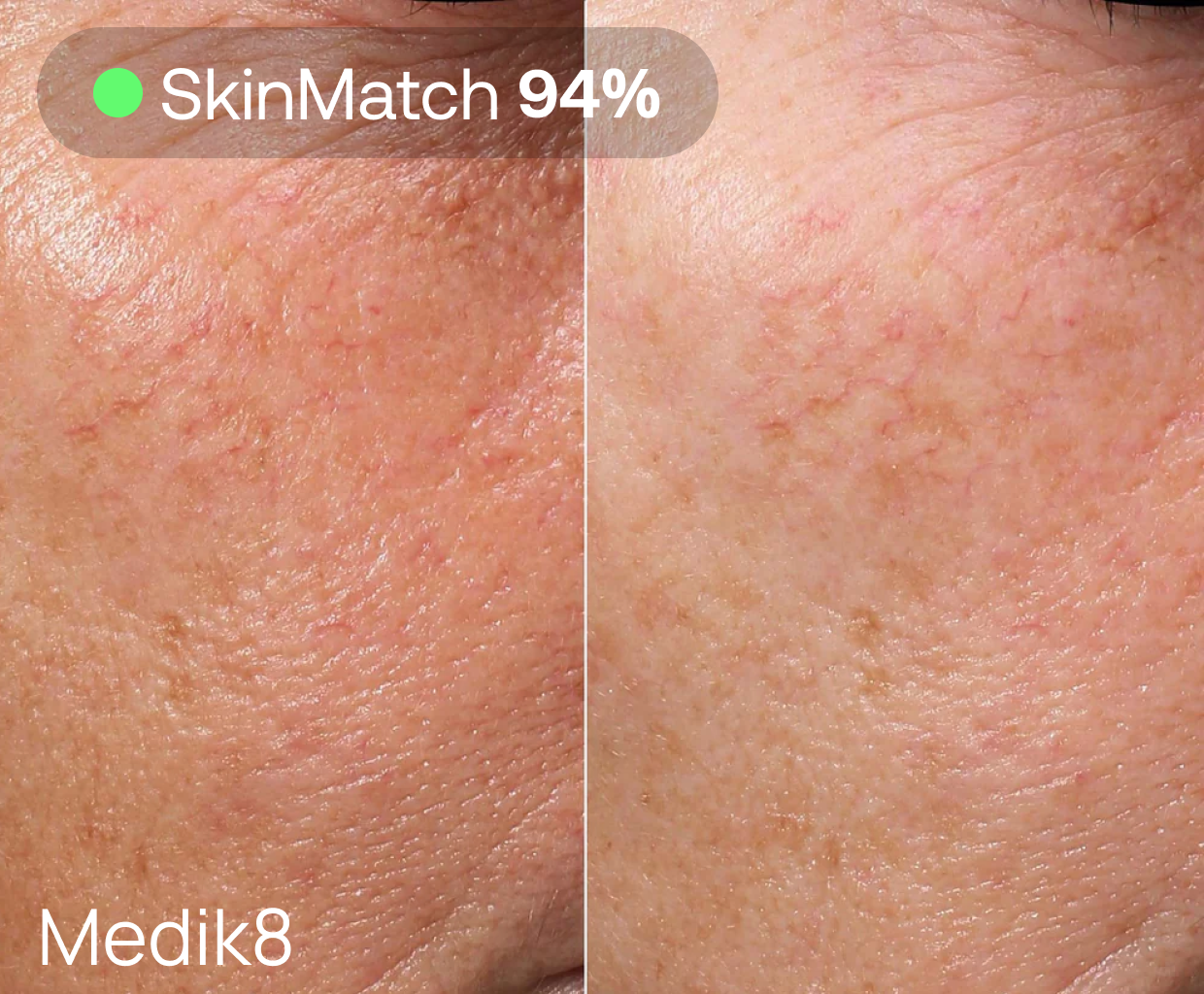 Partial view of a before and after comparison showing skin improvement, possibly in pigmentation or texture, with a result attributed to MediK8 treatment.